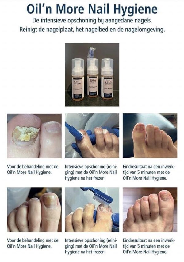 Oil n More nail hygiëne 60 ml - Afbeelding 2
